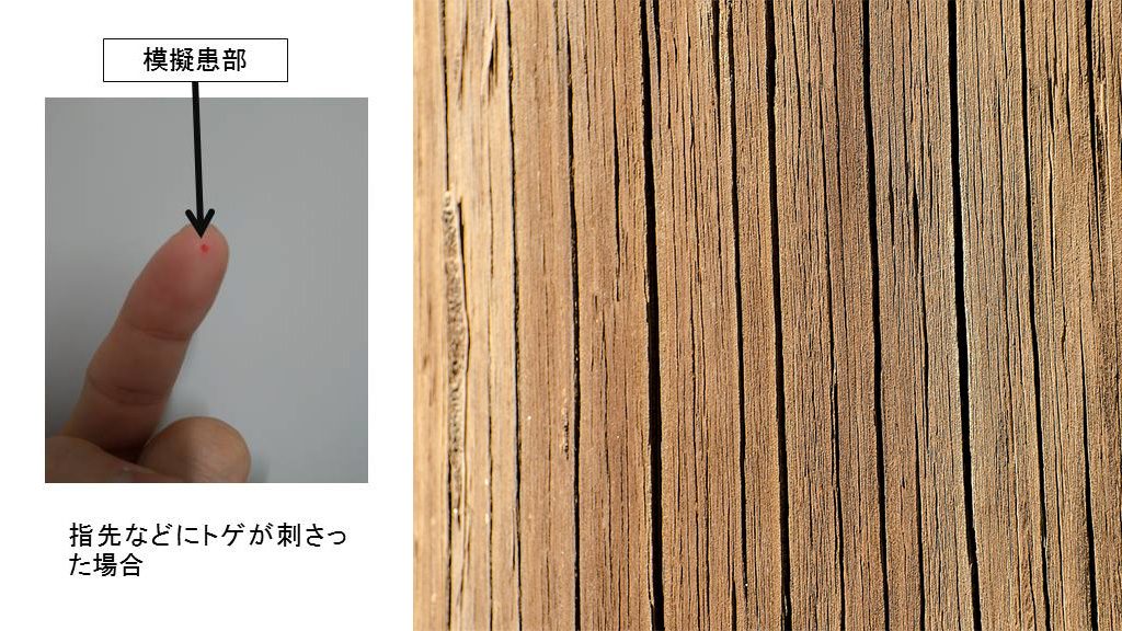 解決木刺傷手煩惱的小工具 日本警視廳警備部災害對策課