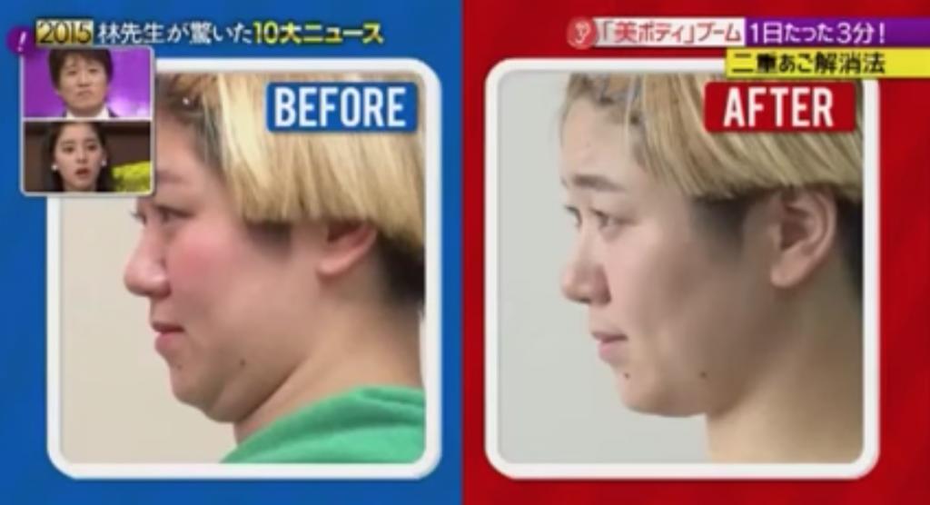 選錯枕頭會導致雙下巴？日本專家教你5秒瘦面操 2星期「V臉」效果驚人