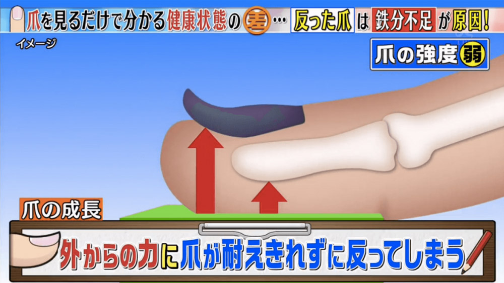 指甲有黑點便是癌症？！日本節目《這個差別是什麼？》教你分辦6個常見指甲健康徵兆