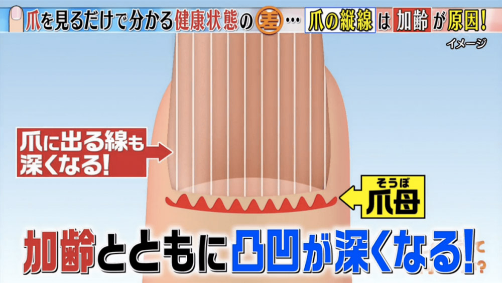 指甲有黑點便是癌症？！日本節目《這個差別是什麼？》教你分辦6個常見指甲健康徵兆