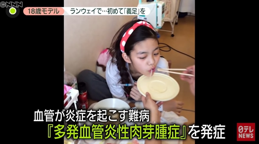  18歲日本少女義肢模特兒：時裝表演中大放異彩 她找回自信的原因？