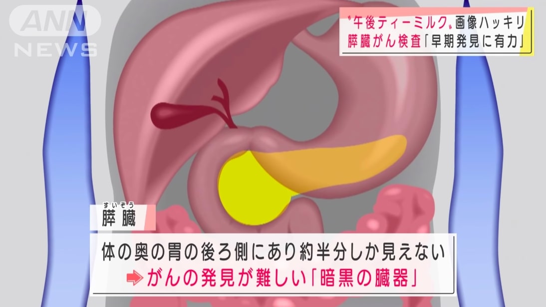 「奶茶救人類！？」意想不到的功能：日本研究發現午後的紅茶有助發現胰臟癌