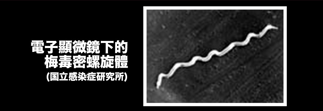 日本性病梅毒患者急增到超過10000人：患者集中20-29歲女性 原因依然不明…